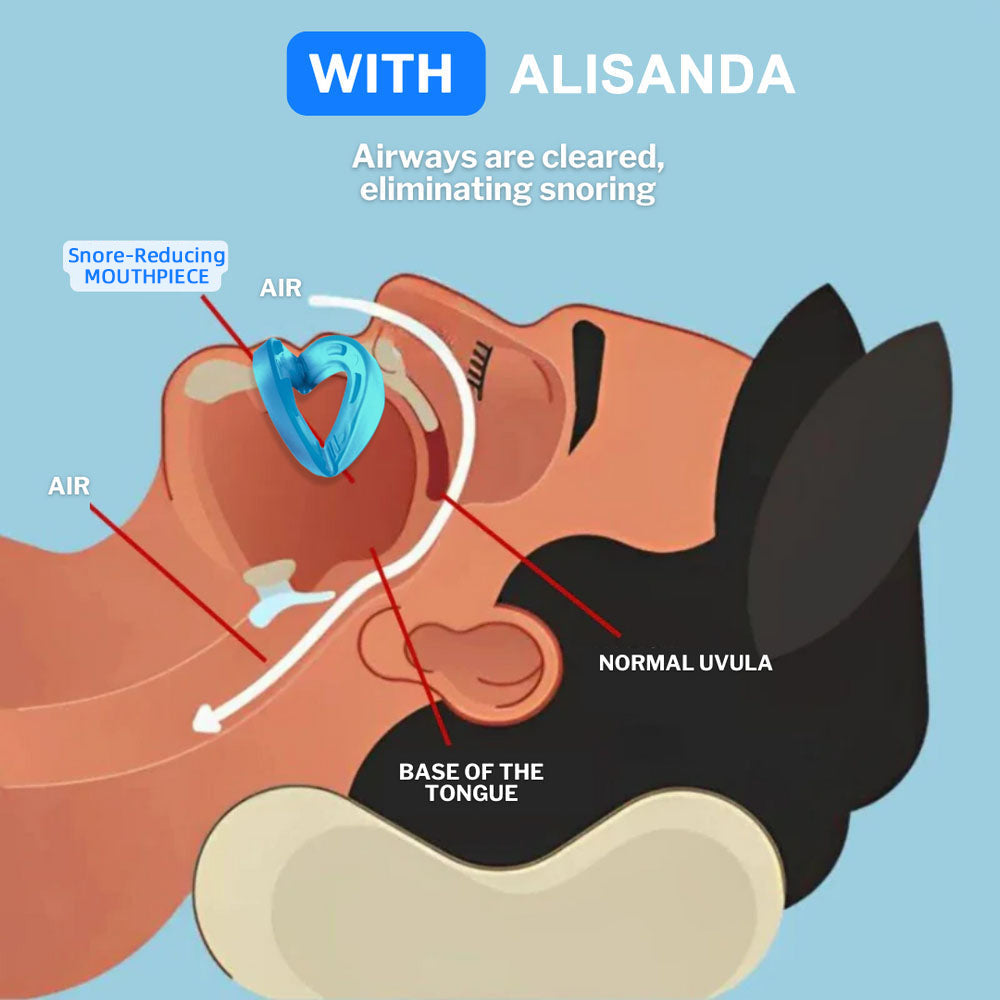LAST DAY SALE 60% OFF ⏰ PerfectSleep Solution – Snore-Reducing & Teeth-Grinding Guard