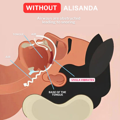 LAST DAY SALE 60% OFF ⏰ PerfectSleep Solution – Snore-Reducing & Teeth-Grinding Guard